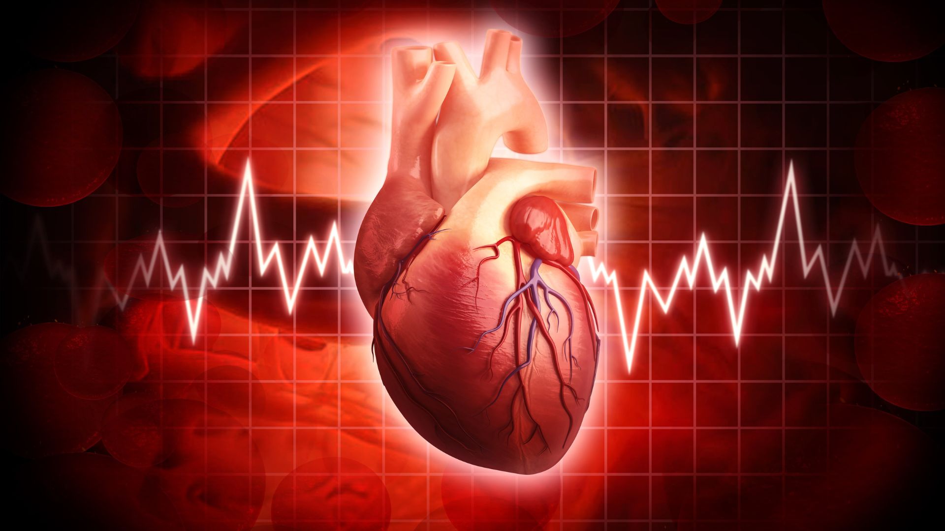 Zdjęcie przedstawia wykres, który obrazuje nierówne bicie serca pacjenta.